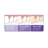 Filtek™ Easy Match Universal-3M